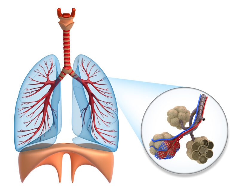 Protect Your Lungs from Wildfire Smoke! - All Thing Autoimmunity